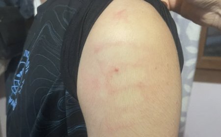Районната прокуратура в Добрич отказа да образува досъдебно производство за побой над дете, нанесен от служител на МВР