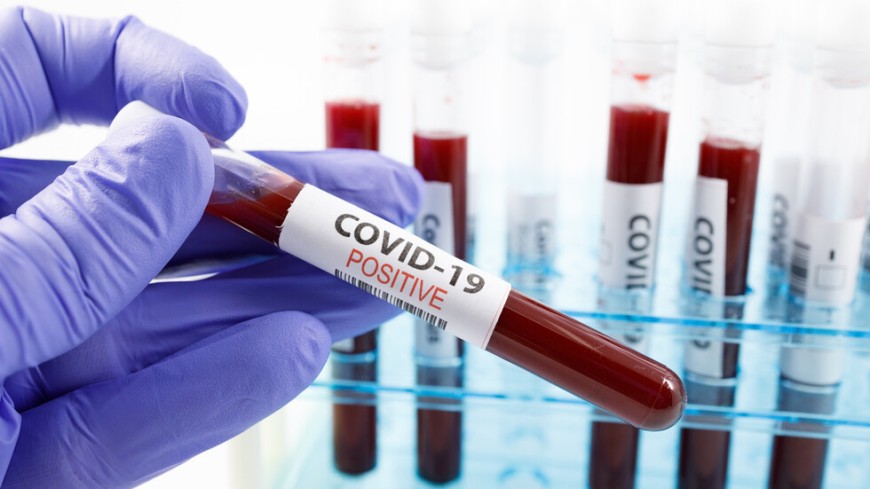 20 области в страната са в тъмночервена зона по заболеваемост от COVID-19 на двуседмична база