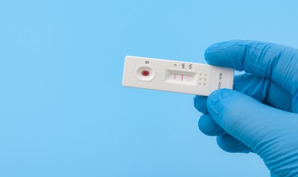 43 са новите случаи на Ковид-19 в област Добрич 