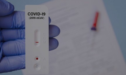 Лекарите отново ще издават направления за безплатни антигенни тестове за COVID-19
